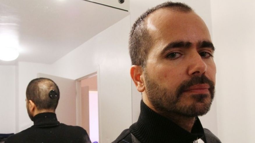 This is an image of Photography Professor Wafaa Bilal who has modified his body by implanting a camera in his head as an art project.