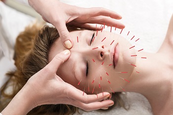 This is a picture of a woman who is undergoing an acupuncture treatment.  She has several needles placed in her face as the practitioner applies pressure to her forehead.