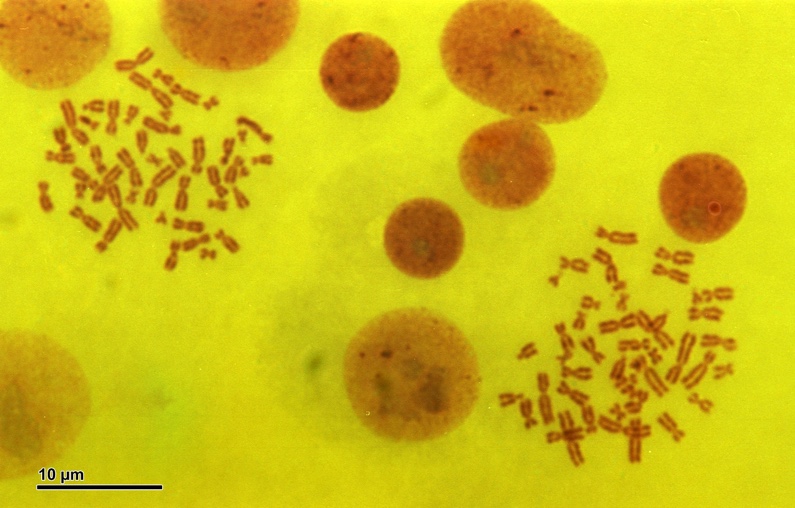 This is an image of a micrograph showing nine red circles of varying sizes along the top and left edges of the image and down the centre. The circles are reddish-orange and are on a yellow background. At the top left, there are 46 X-shaped chromosomes of various sizes arranged in a bunch. There is a second bunch of X-shaped chromosomes at the lower right of the image. Each chromosome is reddish-orange in colour.