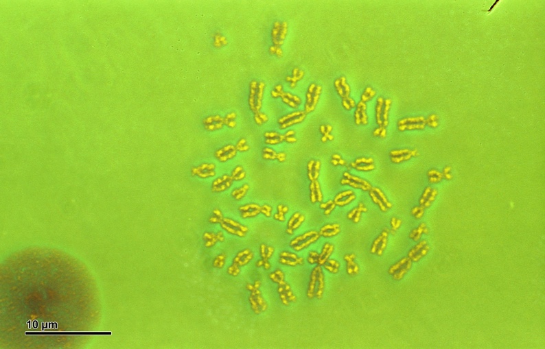This is an image of a micrograph with a lime-green background. There is a reddish-brown circle at the bottom left of the image, with darker spots in the centre. In the middle of the image is 46 X-shaped chromosomes of different sizes spread out in a region that takes up half of the image. The chromosomes are yellow in colour.