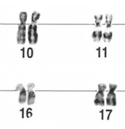 This is an image of a section of a karyotype showing four pairs of grey chromosomes arranged neatly in two columns. The chromosomes in each pair are side by side.  In each row, there is a solid black line that runs horizontally through the chromosomes where all four arms of the X shape meet. Each chromosome pair has a number written below it. The top pairs are labelled 10 and 11 from left to right, and the lower pairs are labelled 16 and 17 left to right. Although each chromosome appears to be rod-shaped, contrast in the grey colouring shows a faint X shape in each chromosome.