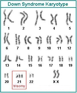 This is an image of a karyotype showing chromosomes that have been paired up with matching chromosomes. The chromosomes appear as rod-shaped strands of different lengths with light and dark grey banding along their length. The chromosome pairs are arranged neatly into four rows. Below each pair is a number.  The top row have pairs numbered 1 to 5, the second row has pairs numbered 6 to 12, the third row has pairs labelled 13 to 19, and the last row has pairs labelled 20 to 22. The last pair on the right has the label ‘XX’ below it.  The 21st position shows three chromosomes and has a red box around it labelled ‘trisomy.' They grey coloured chromosomes are on a white background. There is a thin-blue border, and a title at the top that says ‘Down Syndrome Karyotype.'