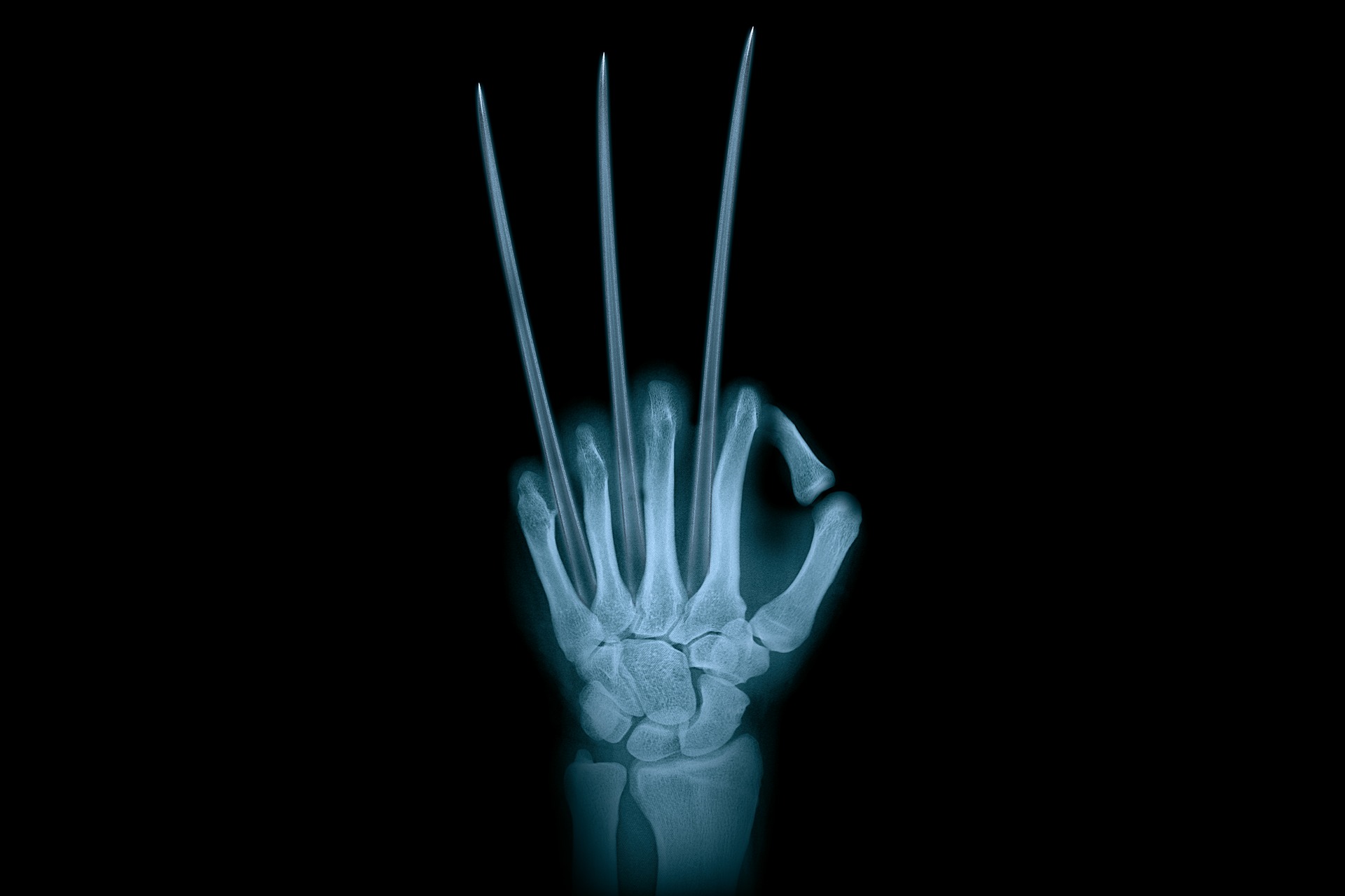 This is an image of an x-ray on a black background. The image on the x-ray is a hand coming up from the bottom with the fingers curled in a fist. Between each finger is a long blade-like extension, indicating that this is an x-ray of the X-men’s Wolverine.