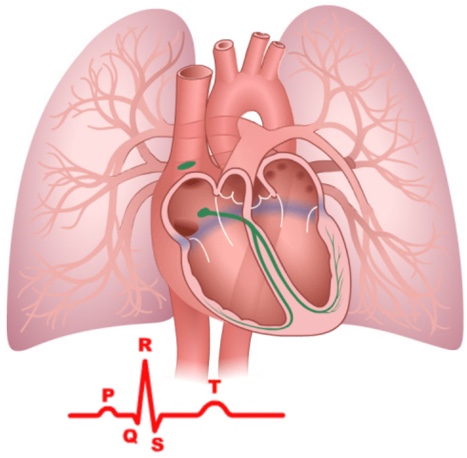This is a screenshot from the ECG animation.