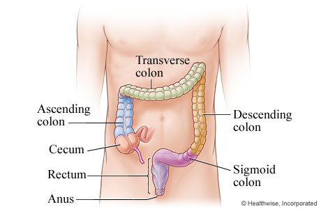 This is a diagram of a male human torso. Superimposed on the abdomen is the large intestine. Starting just below the navel on the left is the end of a large tube labelled ‘Cecum.' The tube continues upwards along the left side of the body. This section is labelled ‘Ascending colon’ and is blue in colour. The tube then make a 90 degree turn to the right and crosses above the navel horizontally. This section is light green and is labelled ‘Transverse colon.' The tube then takes a 90 degree turn down and runs vertically down the right side. This section is yellow in colour. The last section is purple, and shaped like an ‘S’ and is labelled ‘Sigmoid colon.' The lower part of the S shape points straight down at the bottom of the image. The last vertical section is labelled ‘Rectum’, and the very end is labelled ‘Anus.’