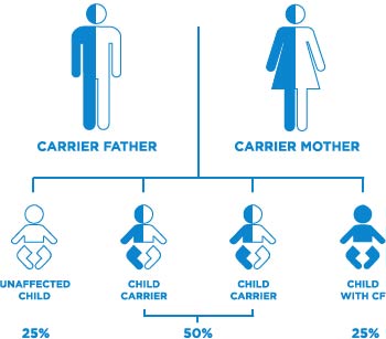 This is a diagram showing two parents and the possible offspring. The symbols representing the people are non-descript outlines similar to the ones found on washroom signs. In the top-left is a man labelled ‘Carrier Father. The left side of the symbol is blue, and the right side is white. To his right is the symbol for a woman. Her left side is blue and her right side is white. The label ‘Carrier Mother’ is below her. There is a vertical line between the two parents that connects to a horizontal line with four symbols representing babies evenly spread out left to right under the horizontal line. The symbol for the baby on the left is all white, and is labelled ‘Unaffected Child’ and then ‘25%’ below that. The next two symbols to the right are both coloured blue on the left and white on the right. Under each symbol is the label ‘Child Carrier’. There is a bracket below these two babies with a label stating ‘50%’. The last symbol on the right of the image is all blue, and is labelled ‘Child with CF’ and then ‘25%’ below that.
