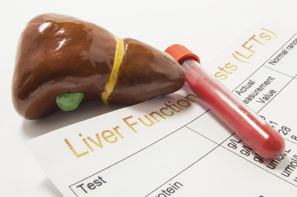 A model of a human liver next to a sealed test tube of blood. Under the liver and test tube is a medical report with illegible words and numbers on it.