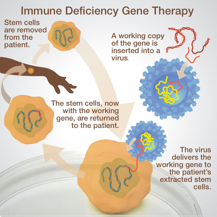 A flowchart titled “Immune Deficiency Gene Therapy.” In the top left is a caption that reads, “Stem cells are removed from the patient.” Below this is a silhouette of an arm with a cartoon of a cell in the middle of the forearm. An arrow from this cell points up to a larger version of the same cell. The nucleus is now visible and contains a blue and brown twisted string. To the right of this is a picture showing orange and red twisted strings. One orange string is apart from the rest. An arrow points from the orange string to a cartoon of a spherical virus. Inside the virus is a yellow tangled string and a shorter orange string. A caption here reads, “A working copy of the gene is inserted into a virus.” A long arrow points down from the larger cell to a similar cell with a virus on its membrane. The orange string is partly in the virus and partly in the cell and attached to the blue and brown twisted strings. A caption to the right of this reads, “The virus delivers the working gene to the patient’s extracted stem cell.” An arrow points back towards the arm and points to a cell with blue, brown, and orange twisted strings. A final arrow points from this cell to the arm. Beside the arrow is written, “The stem cells, now with the working gene, are returned to the patient.”