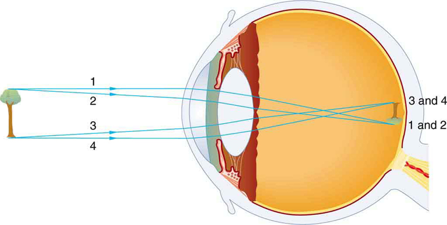 This is an image of a cross section of an eye with four rays coming in from the object, which is a tree. The four rays enter the eye and converge to form an image on the retina that is inverted and smaller than the object.